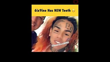 Exposed 69 6ix9ine